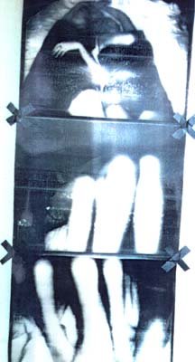 xray